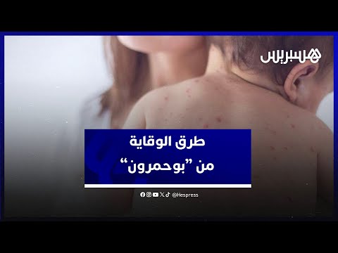 انتشار "بوحمرون".. عفيفي يوضح أعراض المرض ويعطي نصائح لأولياء الأمور للحفاظ على سلامة أطفالهم