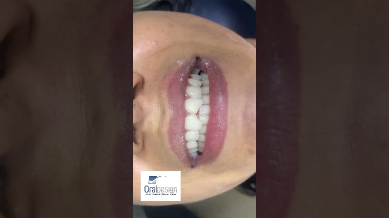 Danilo Monteiro Rezende Pereira-28