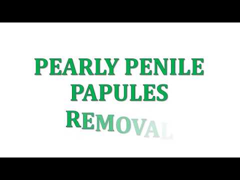 How to remove Pearly Penile Papules at home fast and easy