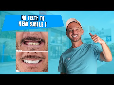 UK Patient's All-on-6 Dental Implants in Turkey | Full Smile Makeover Journey