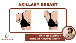 Axillary Breasts - By Dr.Swapna Athavale ( Plastic Surgeon in Pune )