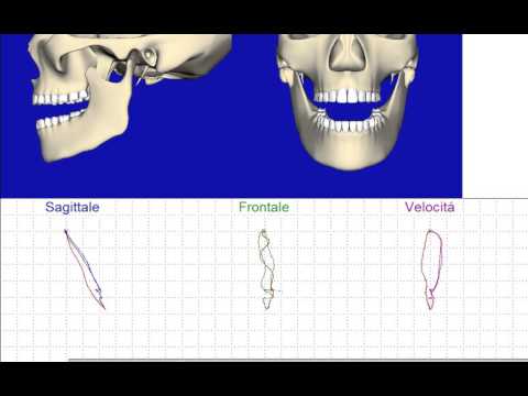 Buona pomata di mal di schiena Legamenti nel trattamento distorsione alla caviglia