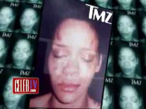 Rihanna beated photos released (chris brown beating)
