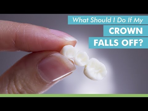 download lagu mp3 mp4 What To Do If A Crown Falls Out, download lagu What To Do If A Crown Falls Out gratis, unduh video klip What To Do If A Crown Falls Out
