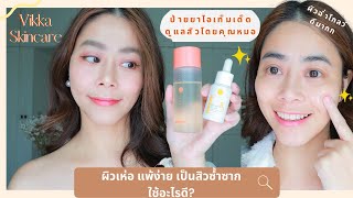 ผิวเห่อ แพ้ง่าย เป็นสิวซ้ำซาก ใช้อะไรดี? ป้ายยาไอเท็มเด็ดดูแลสิวโดยคุณหมอ Vikka Skincare