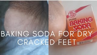 How To Remove Dry, Dead and Cracked Skin From Feet At Home| DIY| Using Baking Soda