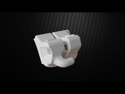LightForce 2.0: Fully Custom Brackets for Every Tooth