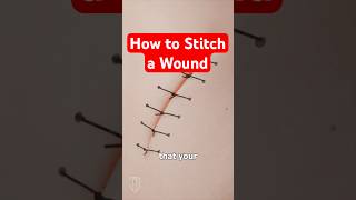 Science Behind Stitches Explained & How Sutures Work #medical #medicalstudent #nursingstudent