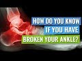 How Do You Know Whether You Have Broken Your Ankle