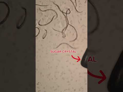 Sugar vs Parasites under the Microscope #health #guthealth #naturalremedies #viralshort