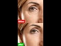 Incredible! 2 ingredients remove wrinkles and tighten the skin