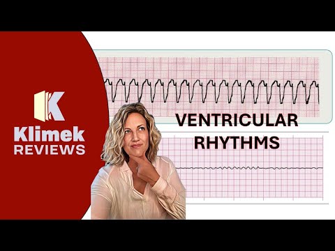 NCLEX PREP: VENTRICULAR RHYTHMS