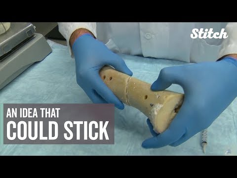 Researchers create new bone glue to fix a broken bodies.