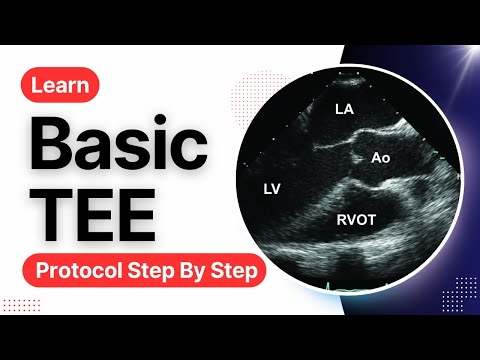 16 Views to Master in Transesophageal Echocardiography (TEE)