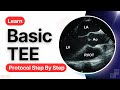 16 Views to Master in Transesophageal Echocardiography (TEE)