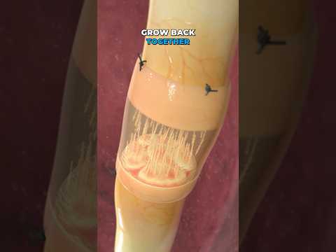 Repairing a severed nerve (3D Animation)