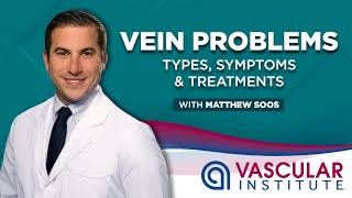 Understanding Varicose Veins | Causes, Symptoms & Treatment with Matthew Soos, NP