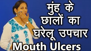 मुहं के छालों के घरेलू उपचार । Home remedies for Mouth Ulcers | Ms Pinky Madaan