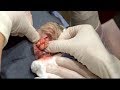 Bon appétit bien sûr ! - Docteur Pimple Popper