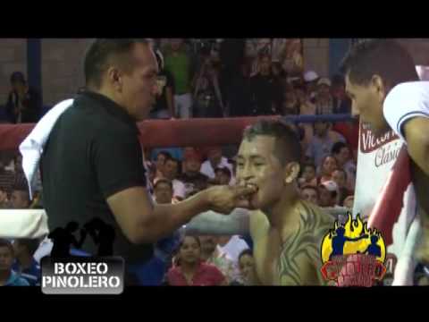 MATAGALPA, 8/02/2014