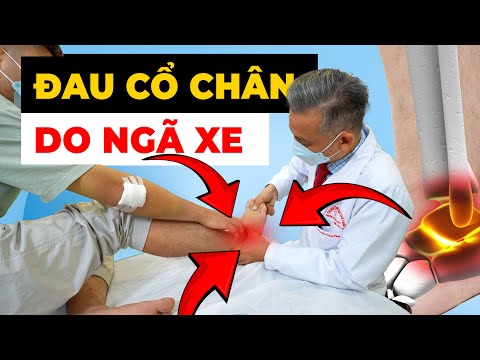 Chớ Xem Thường Đau Cổ Chân Sau Ngã Xe: Bí Quyết Phục Hồi Hiệu Quả!