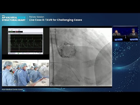 [AP VALVES & SH 2023] Live Case 8: TAVR for Challenging Cases