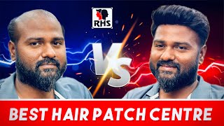 Best Hair Patch Clip System | Best Hair Patch For Men | Natural Hairline Patch System | 9599858612