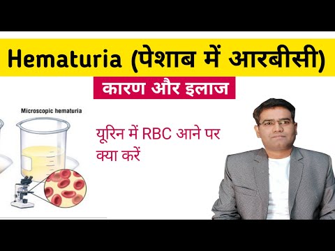 Hematuria (RBC in Urine) Causes Investigation and Treatment (Explained in Hindi)