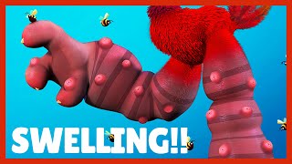 The Swelling! | Cracké | Games For Kids