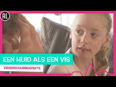 SCHUBBEN ALS HUID - TOPDOKS NET FF ANDERS ELIN