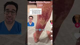 What Is HSP (Henoch-Schönlein Purpura)? 🤒 | Dr. Yoshi on Symptoms & Treatment