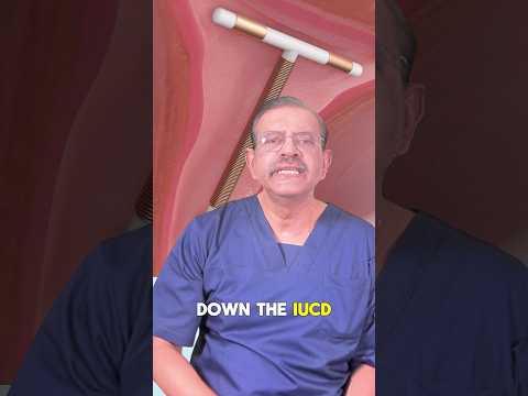 Kann man mit einer Spirale schwanger werden?