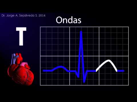 download lagu mp3 mp4 Electrocardiograma, download lagu Electrocardiograma gratis, unduh video klip Download Electrocardiograma Mp3 dan Mp4 Full Gratis