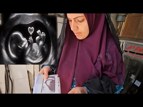 We finally went for an ultrasound of our sixth child! The results shocked us 🧨