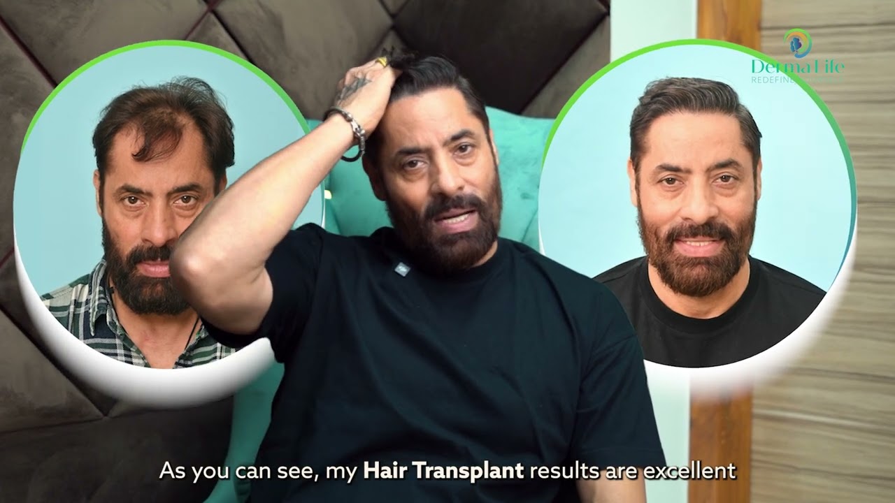 Dermalife - Best Skin and Hair Clinic in Delhi