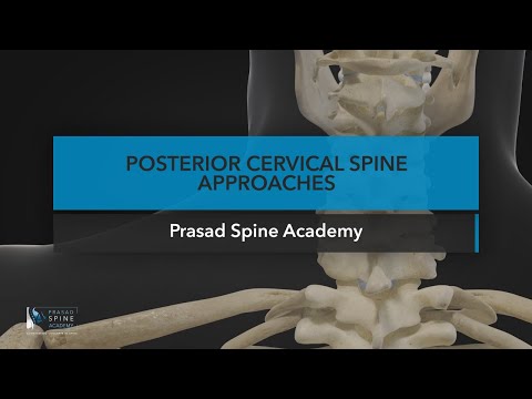 Posterior Cervical Spine Approaches [Chapter 9 Full]