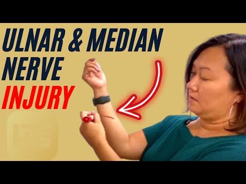 Ulnar & Median Nerve Injury | Case Review For Occupational Therapists and Hand Therapists
