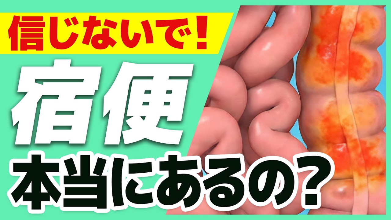 宿便の本当のところ。長年古く溜まった物なの？その正体は？