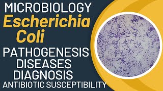 Download lagu Escherichia coli pathogenesis | E. coli microbiology | e. coli general properties mp3