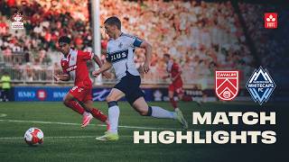ADVANCED ???? | Vancouver Whitecaps FC vs Cavalry FC Leg 2 HIGHLIGHTS