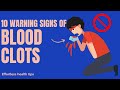 Top 10 Warning Signs Of Blood Clots You Should Not Ignore