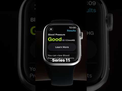 Apple Watch Series 11 rumors