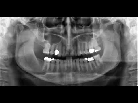 Comprehensive panoramic anatomy review