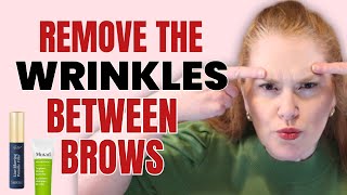 How To Get Rid Of The 11 Lines on Your Face