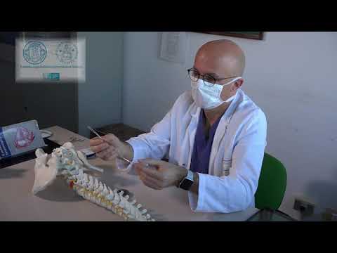 Pacemaker spinale per il mal di schiena cronico impiantato a Siena per la prima volta in Italia