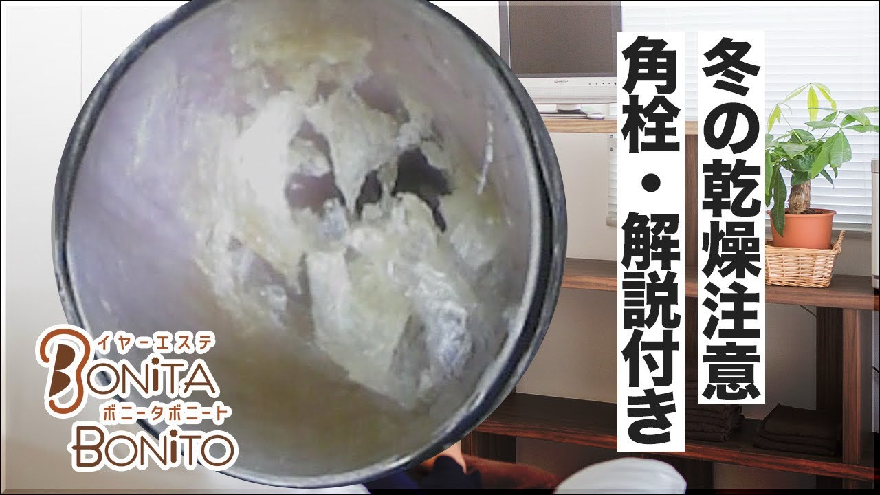 #耳掃除 冬の乾燥注意⚠️角栓・解説付き