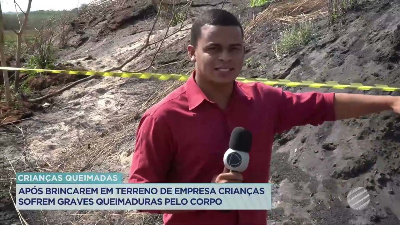 APÓS BRINCAREM EM TERRENO DE EMPRESA, CRIANÇAS SOFREM GRAVES QUEIMADURAS PELO CORPO