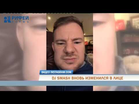 Dj Smash, beaten by Perm ex-deputy, showed his disfigured face