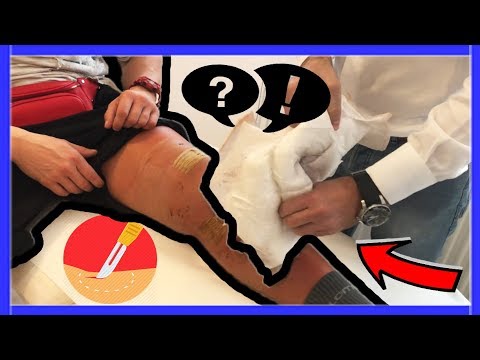 crema pentru osteochondroza lombara