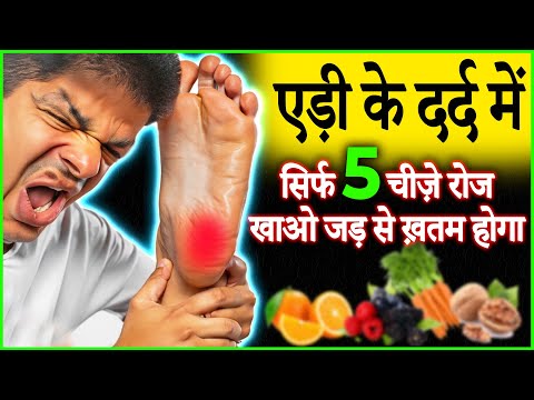 5 Best Heel Pain Relief Tips 2023 | Plantar Fasciitis
